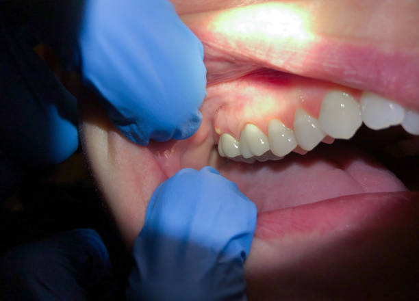 Best Emergency Dentist for Special Needs Patients in Holly, MI