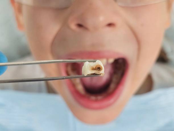 Best Weekend Emergency Dentist in Holly, MI